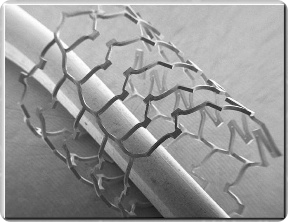 Scanning electron micrograph of nanopatterned Ti stent
