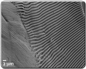 Surface of a nanopatterned stent